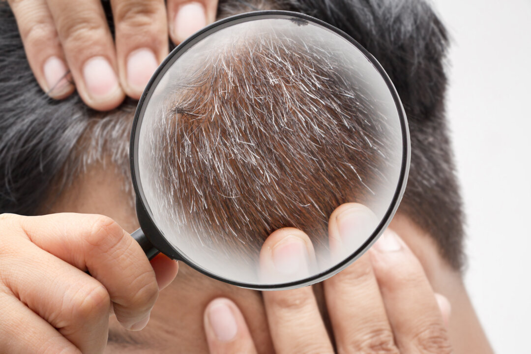Researchers were able to prove that once a hair turns grey, it doesn't always stay that way.(namtipStudio/Shutterstock)