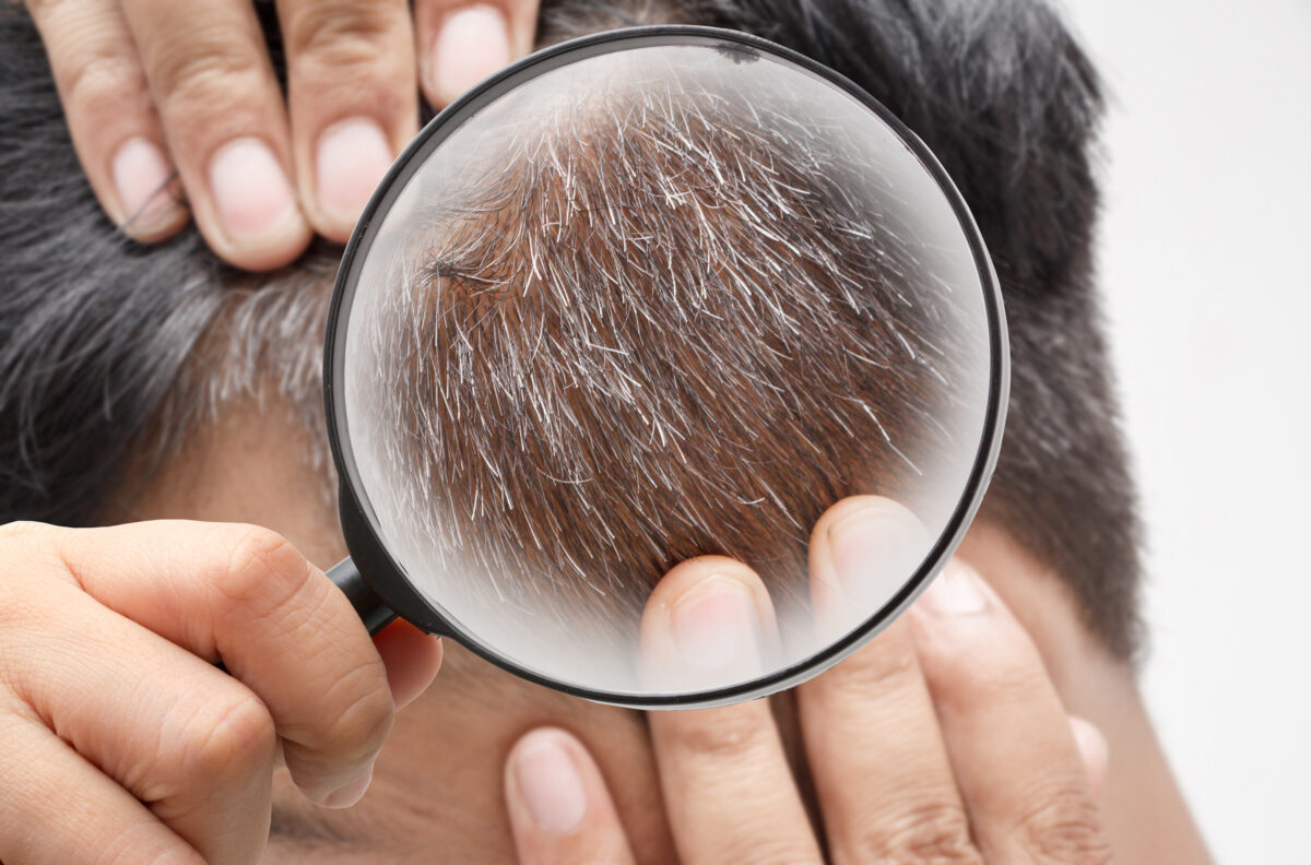 Researchers were able to prove that once a hair turns grey, it doesn't always stay that way.(namtipStudio/Shutterstock)
