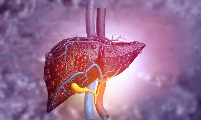 A Ubiquitous 'Forever Toxin' Can Cause Liver Cancer—4 Ways to Avoid It