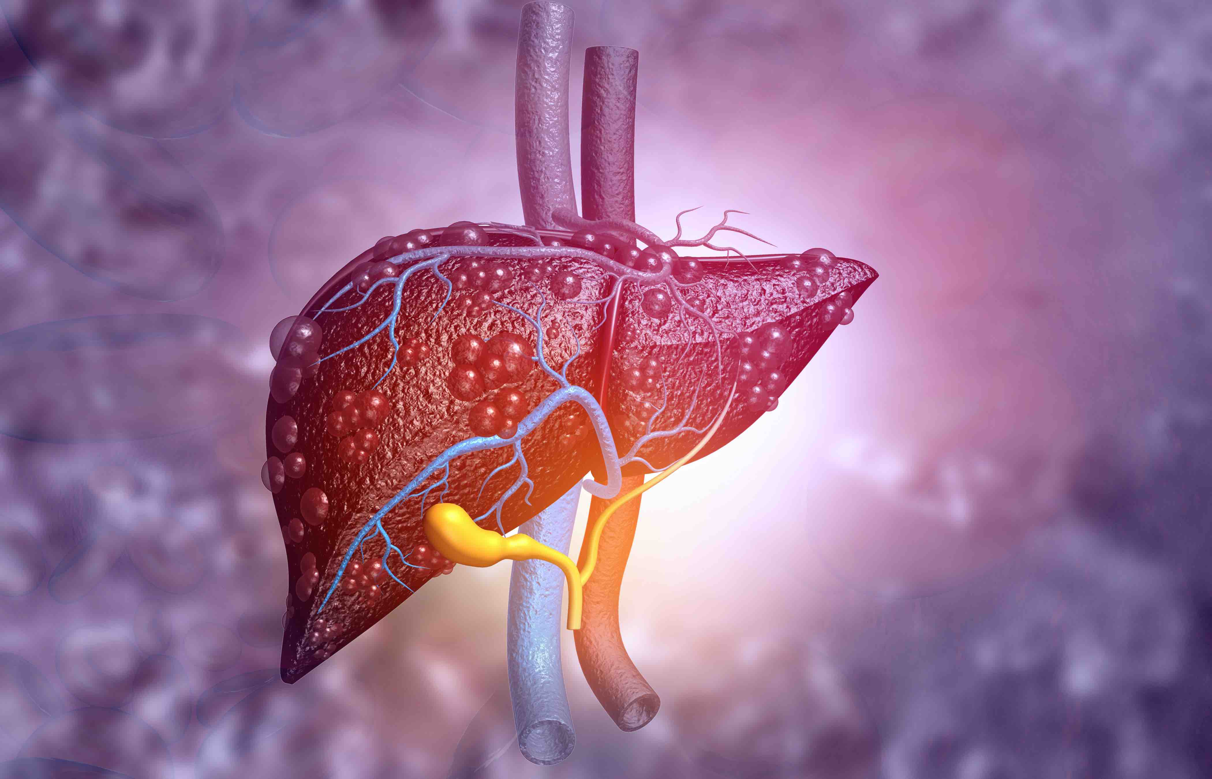 A Ubiquitous 'Forever Toxin' Can Cause Liver Cancer—4 Ways to Avoid It - Vimarsana News