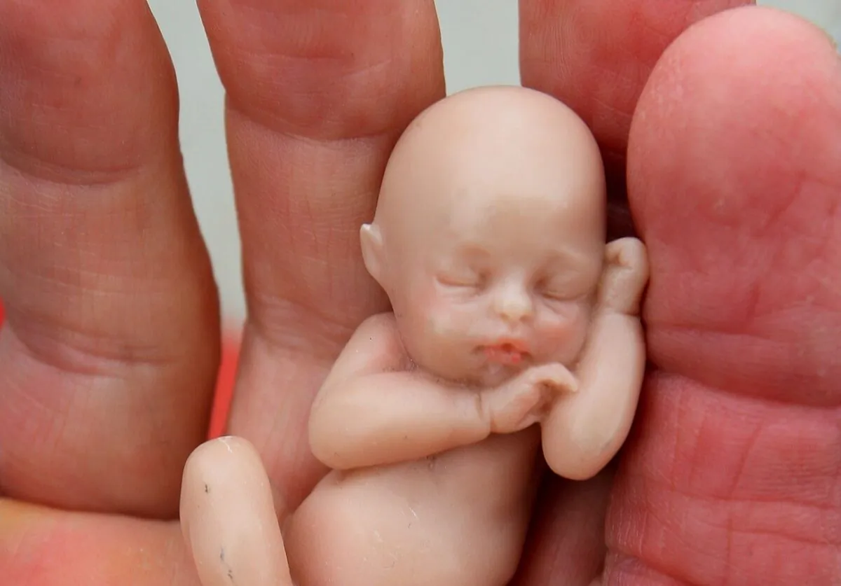 A pro-life supporter holds a model of a fetus while protesting in Aurora, Ill., on Oct. 2, 2007. (Scott Olson/Getty Images)