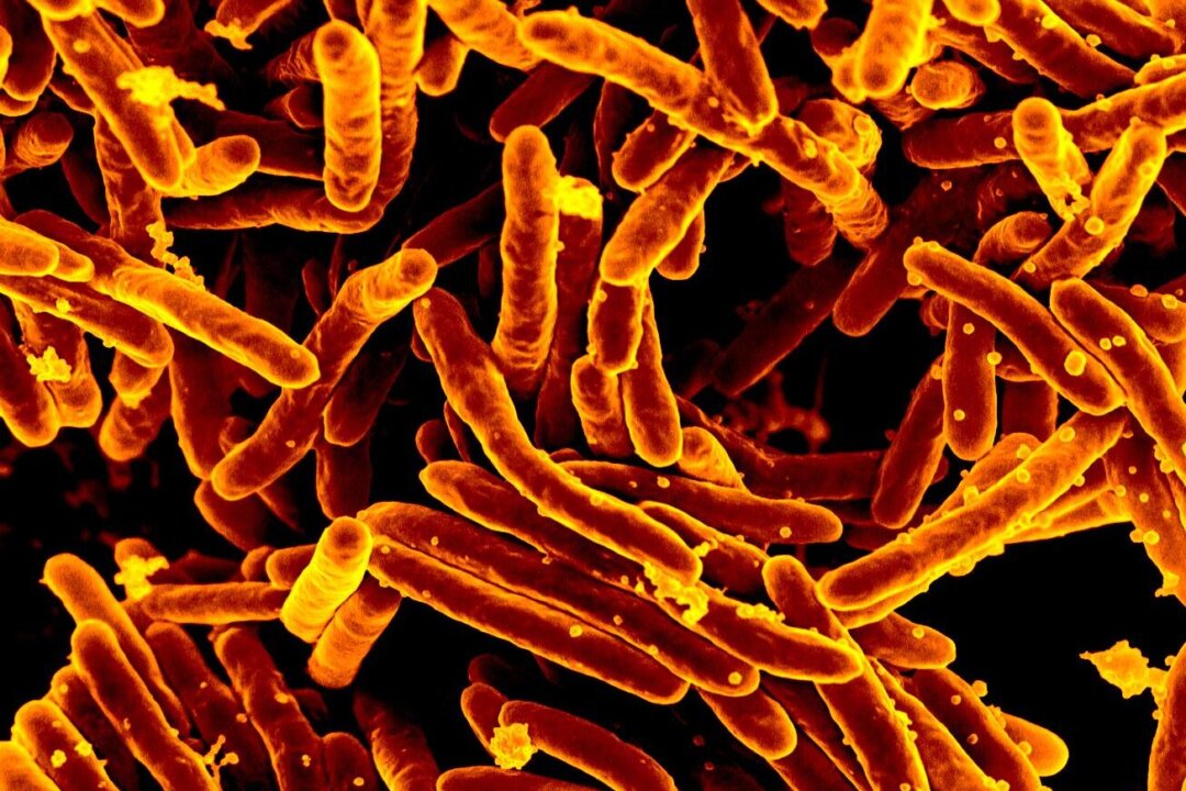 Mycobacterium tuberculosis (Mtb) bacteria.