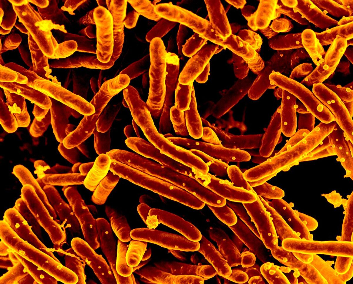 Mycobacterium tuberculosis (Mtb) bacteria.