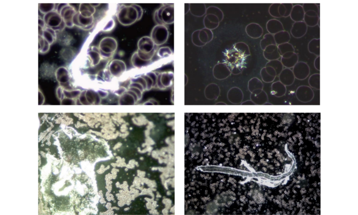 These 4 images illustrate the variety of unusual phenomena and objects found in the blood of subjects
vaccinated with Comirnaty BioNTech/Pfizer (Courtesy of Helen Krenn)