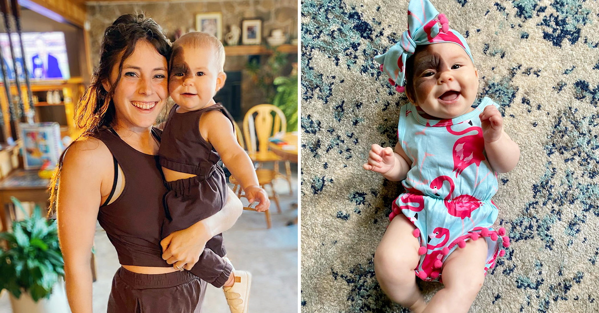 Mom Empowers Daughter Born With Rare Birthmark, and Shares Her Unique Beauty With the World Mom Empowers Daughter Born With Rare Birthmark, and Shares Her Unique Beauty With the World