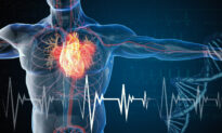 2022 Excess Deaths All Around the World Raise an Alarm