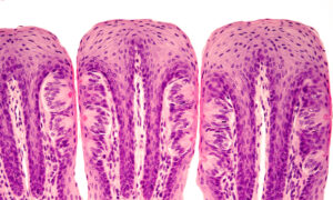 Taste Nerve Reveals Coronavirus Entryways