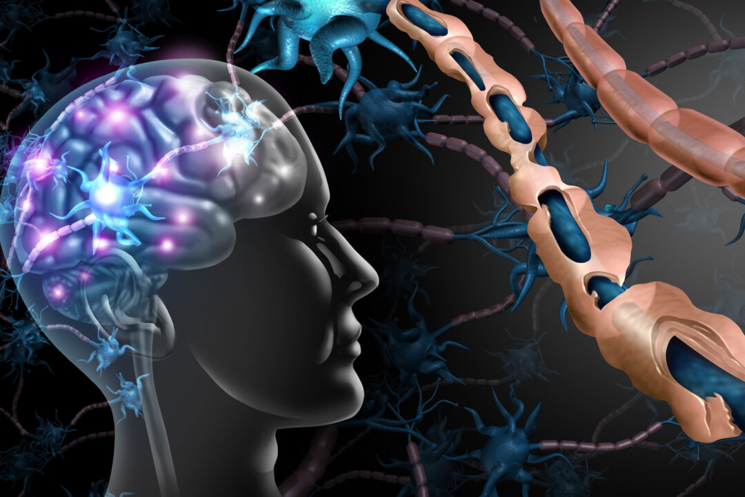 New Study Reveals Surprising Cause of Multiple Sclerosis
