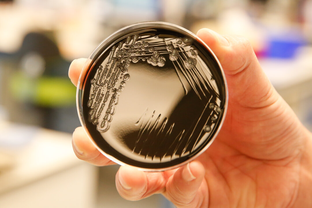 A culture of the Legionella pneumophila bacteria at the UZ Gent hospital in Belgium on May 17, 2019. (Nicholas Maeterlinck/AFP via Getty Images)