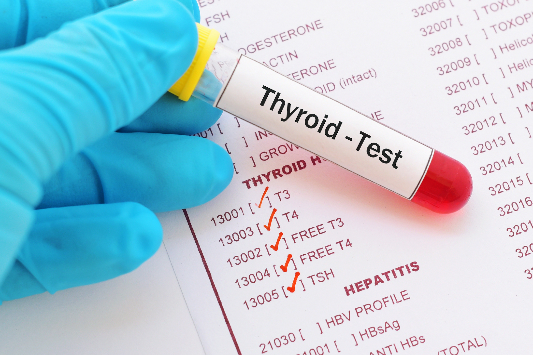 Why Thyroid Tests Lack Accuracy And How To Improve Thyroid Health Without Medications - Vimarsana News