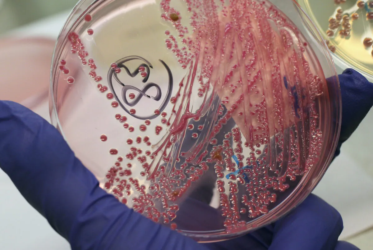 A lab technician holds a bacteria culture that shows a positive infection of enterohemorrhagic E. coli, also known as the EHEC bacteria, from a patient at the University Medical Center Hamburg-Eppendorf in Hamburg, Germany, on June 2, 2011. (Sean Gallup/Getty Images)