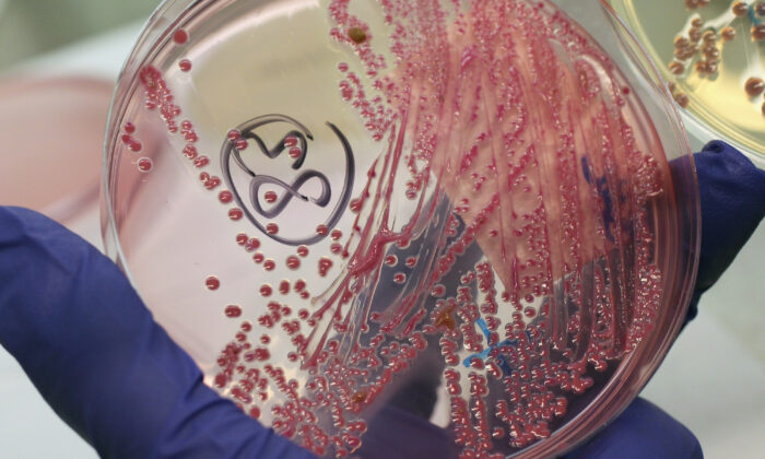 A lab technician holds a bacteria culture that shows a positive infection of enterohemorrhagic E. coli, also known as the EHEC bacteria, from a patient at the University Medical Center Hamburg-Eppendorf in Hamburg, Germany, on June 2, 2011. (Sean Gallup/Getty Images)