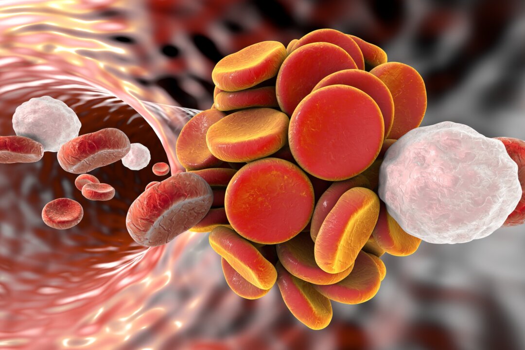 The most important way to prevent a blood clot in your body is to be proactive. (Kateryna Kon/Shutterstock)