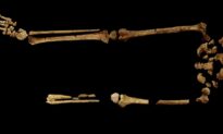 Earliest Known Case of Surgical Amputation Discovered