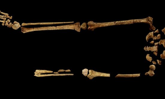 Earliest Known Case of Surgical Amputation Discovered