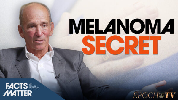 The Surprising Cause of Melanoma, and It’s Not Too Much Sun: Dr. Mercola
