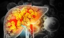 Fix Your Liver: Nonalcoholic Fatty Liver Disease Is Surging in the U.S.