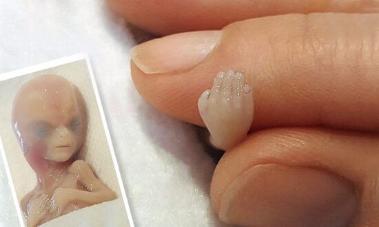 Photos of 'Perfectly Formed' 14-Week Miscarried Baby Are Saving Lives: 'He Was Not Medical Waste'