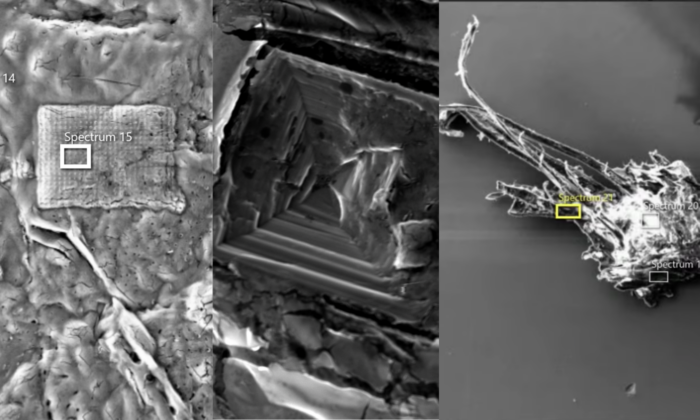 SEM (Scanning Electron Microscope) image from vaccine vials. (Courtesy of Dr. Daniel Nagase)