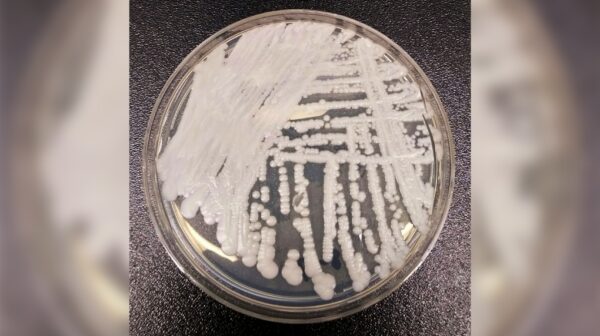 Multidrug-Resistant Fungus Spreading Rapidly in Europe: ECDC