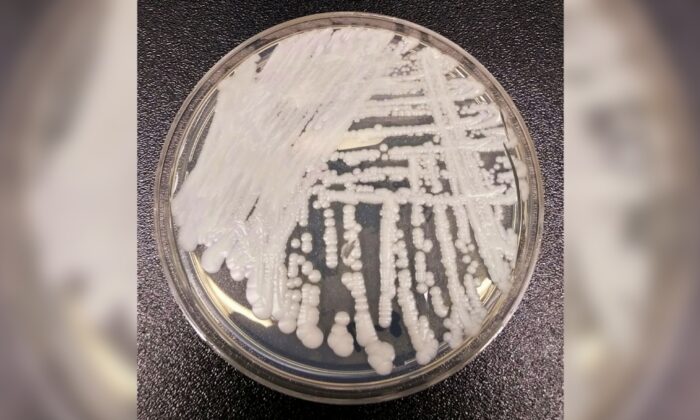 Dangerous Fungal Infection Spreading Through US at ‘Alarming Rate’