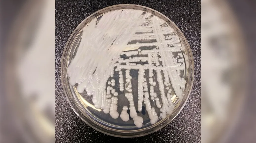 This undated photo made available by the Centers for Disease Control and Prevention shows a strain of Candida auris cultured in a petri dish at a CDC laboratory. (The Canadian Press/Shawn Lockhart-CDC via AP)