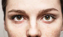 What Your Eyes Reveal About Your Health