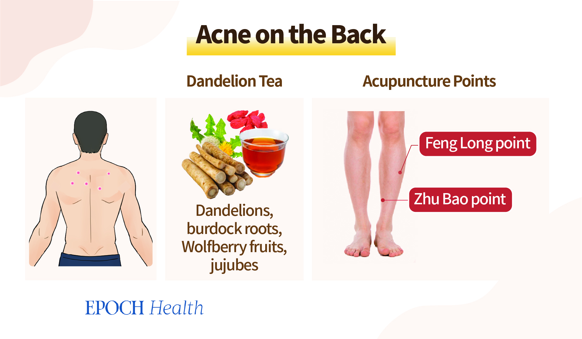 Body Acne? These Key Locations Signify Health Issues