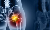 Osteoarthritis Has Doubled in the Last Fifty Years