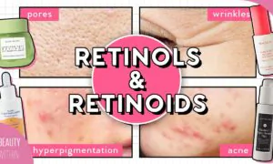 How to Use Retinol for Acne, Hyperpigmentation, Large Pores, Fine Lines, & More! (Not Sponsored)