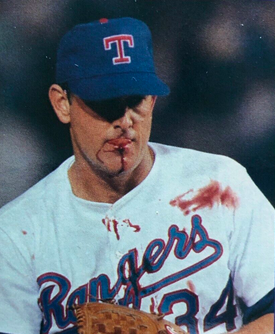 pitcher with bloody lip in facing nolan