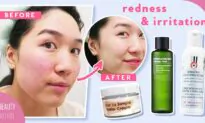 Best 5 Ingredients to Avoid Skin Inflammation & Irritation! (ft. Purito)