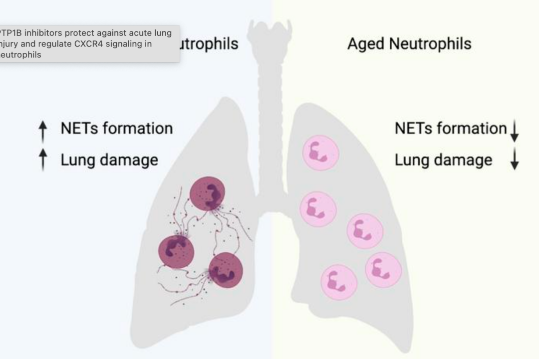 (PTP1B inhibitors protect against acute lung injury and regulate CXCR4 signaling in neutrophils/JCI Insight)