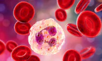 German Study Finds Link Between Inflammation, Aging, and Diet