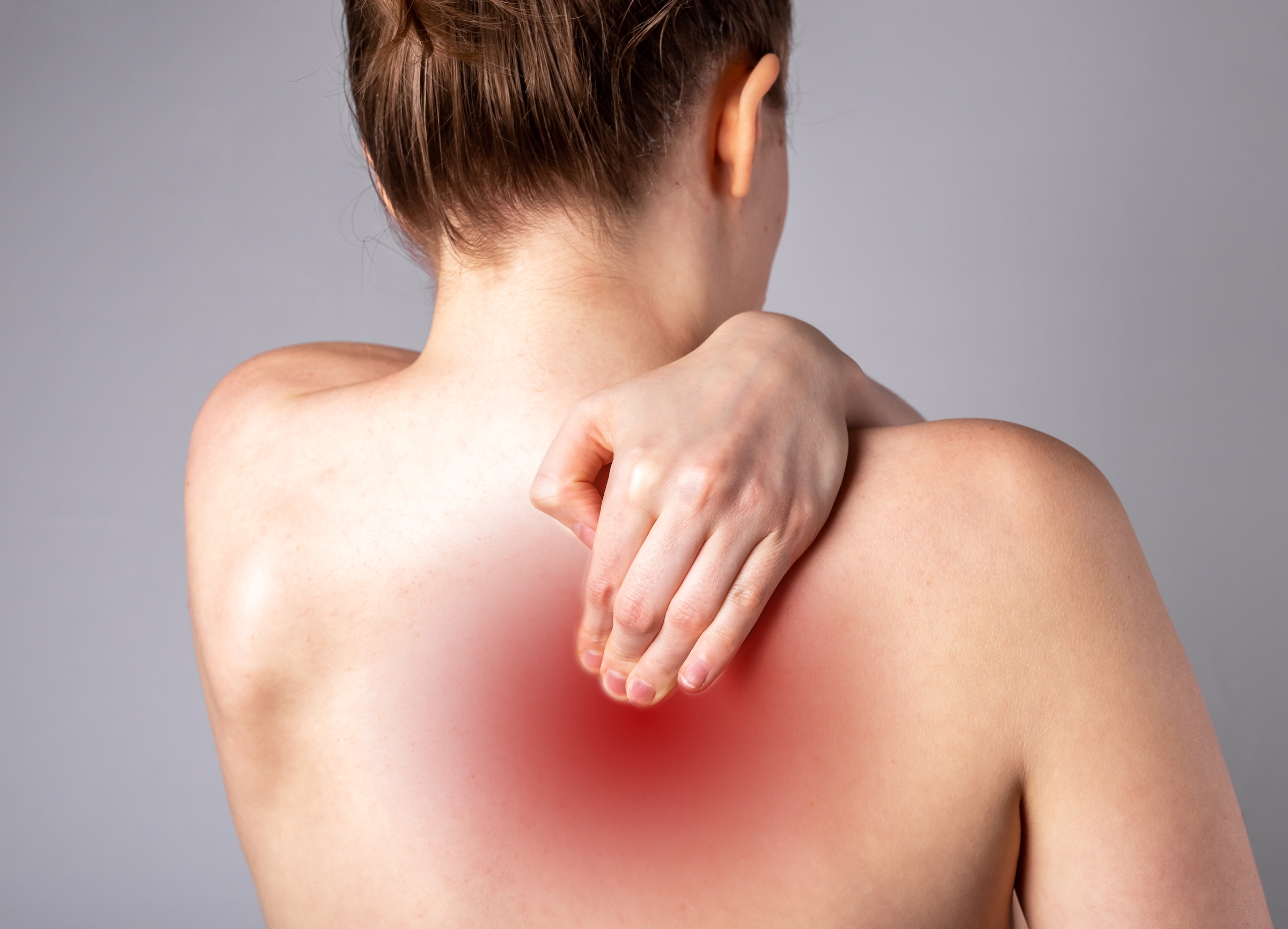 Pinched Shoulder Blade: Causes, Symptoms, Treatments, and Exercises
