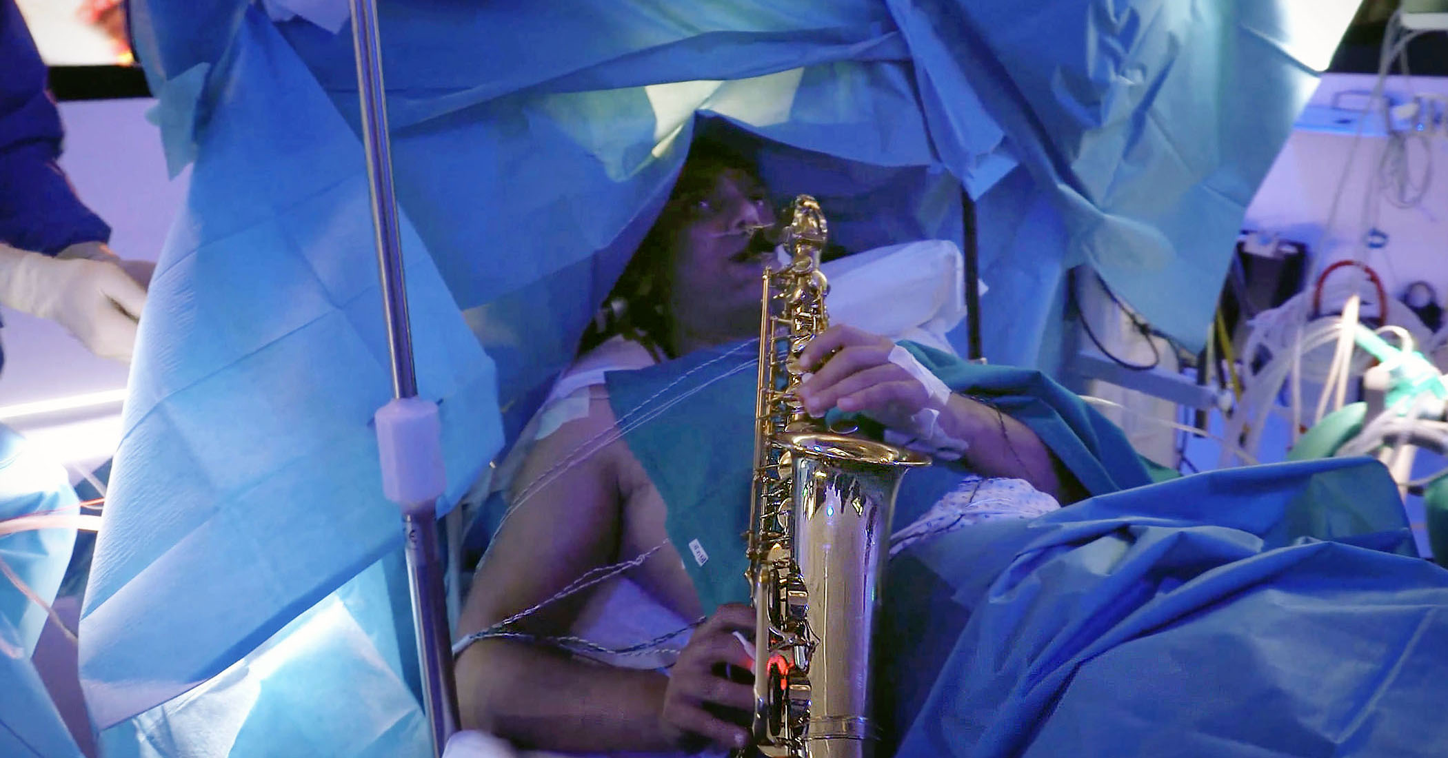 musician-with-brain-cancer-plays-saxophone-during-9-hour-brain-surgery