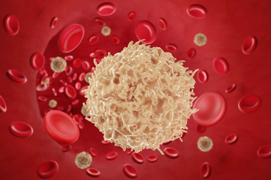 Cancer cell in the bloodstream (Shutterstock)