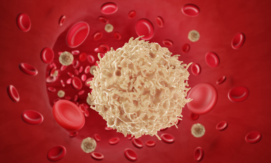 Cellule cancéreuse dans le sang (Shutterstock)