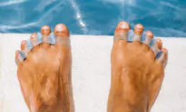 Toe Spacers Play a Role in Correcting Foot Problems
