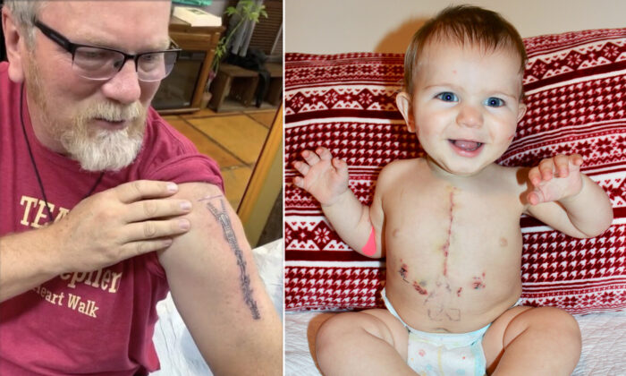 ‘The Deepest Love’: Devoted Grandpa Tattoos Grandson’s Open Heart Surgery Scar on His Arm