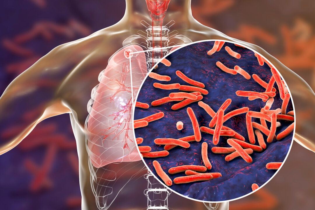 We have long known that some individuals with TB are more infectious than others (Kateryna Kon/Shutterstock)