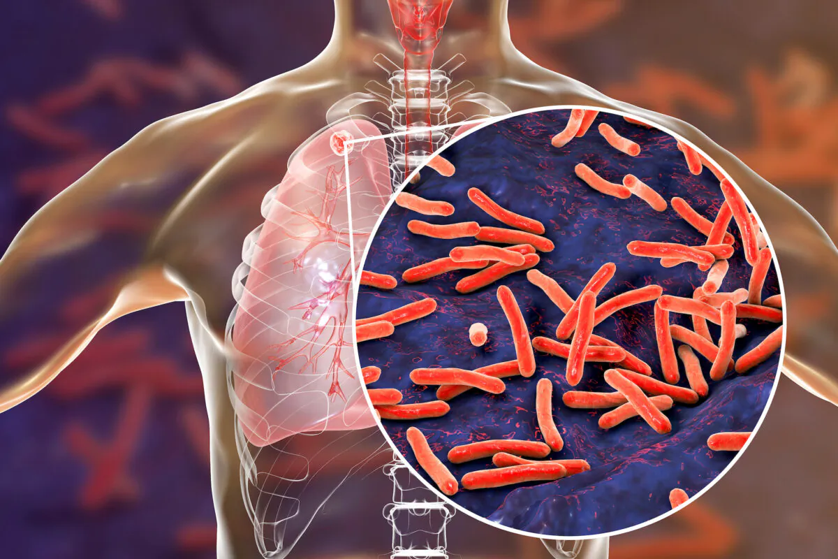 Mycobacterium tuberculosis (Mtb) bacteria. (Kateryna Kon/Shutterstock)