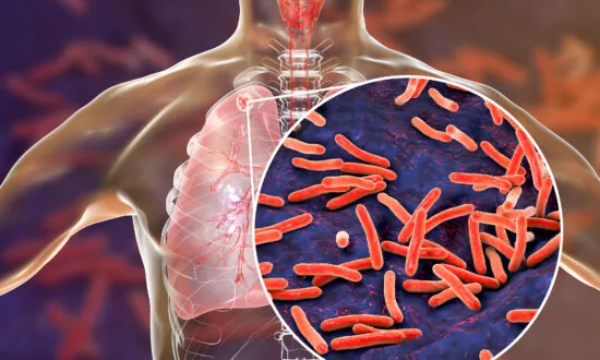 Possible Tuberculosis Exposure Reported at Cal State San Marcos