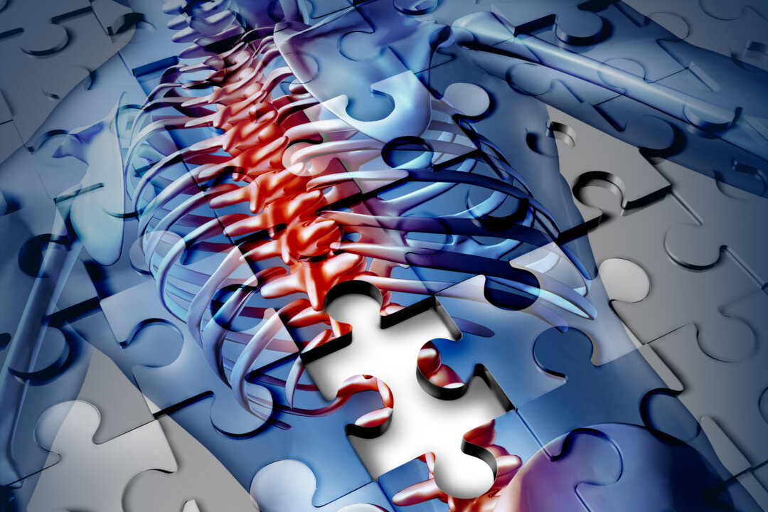 Concerned With Brittle Bones? Discover 4 Natural Ways to Support Bone Health