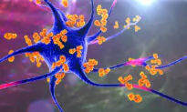 Scientists Say Alzheimer’s Is an Autoimmune Disease, Not Result of Amyloid Plaques