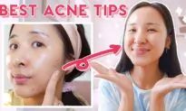 How to Use AHA, BHA, & Niacinamide for Acne & Hyperpigmentation! (Not Sponsored)
