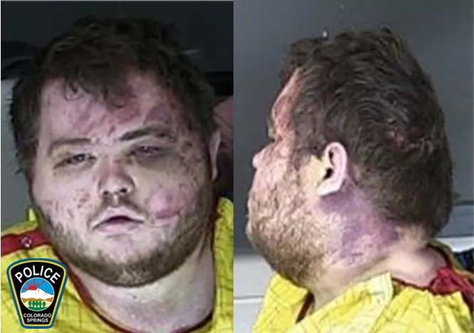 A mugshot of suspect Anderson Lee Aldrich, the suspect in the shooting at  Club Q in Colorado published by police on Nov. 23, 2022 (Colorado Springs Police Department)