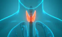 3 Top Causes for Hypothyroidism