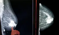 Breast Cancer Care in 2024: What Women Need to Know