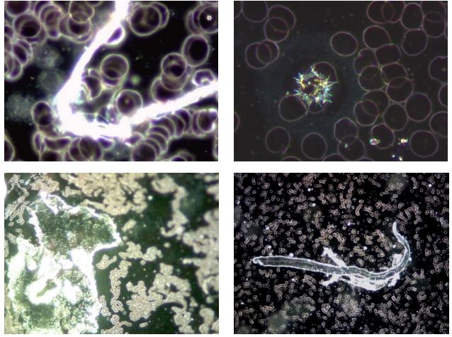 Figure 4: These 4 images illustrate the variety of unusual phenomena and objects found in the blood of subjects
vaccinated with Comirnaty (BioNTech/Pfizer). (German Working Group for COVID Vaccine Analysis (GWG))